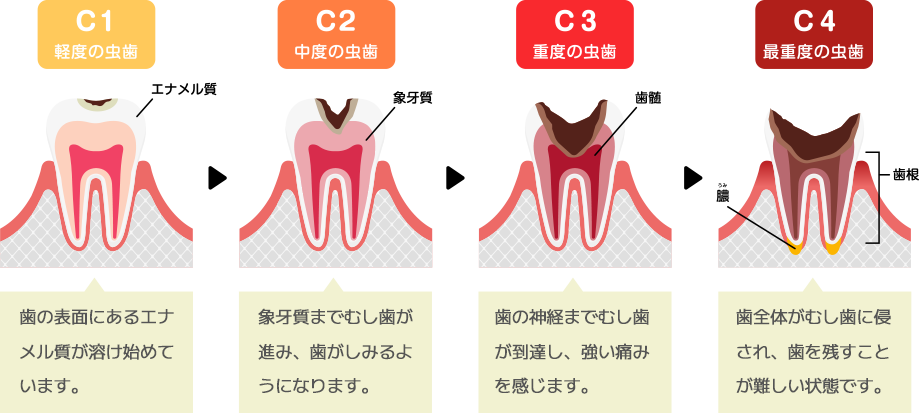 痛みの少ない治療への取り組み