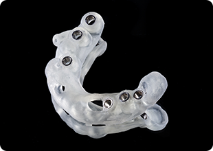 サージカルガイドの導入で、より確実で安全な手術を実現