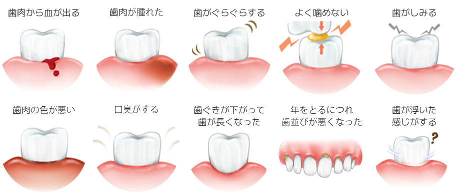 もしかしたら歯周病？このような症状はございませんか？